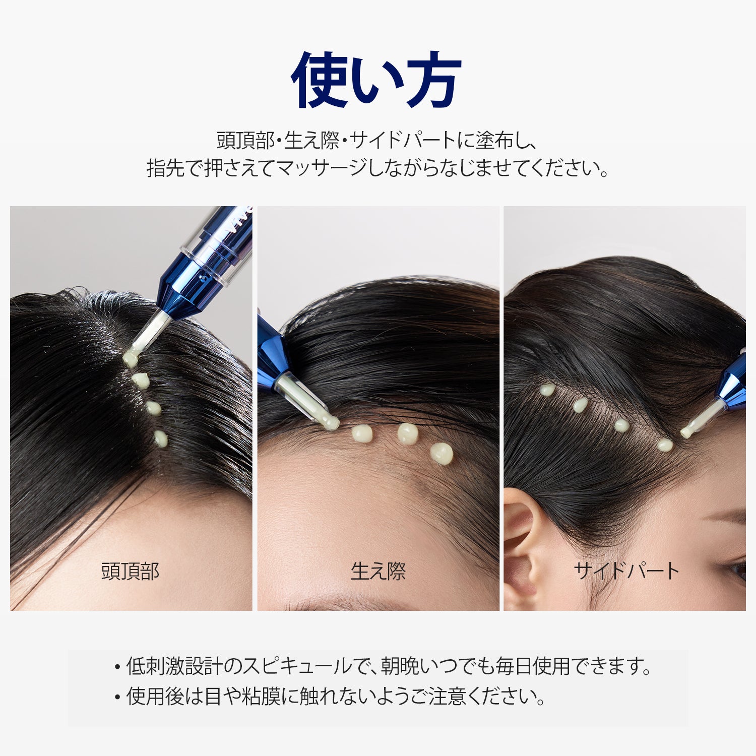 ViveLab Spioxyl™ スカルプセラム 400 ― 22万本マイクロスピキュールで、根元からふんわり濃密ヘアへ｜韓国No.1売上・皮膚科医推奨のK-Beautyスカルプセラム（15ml）